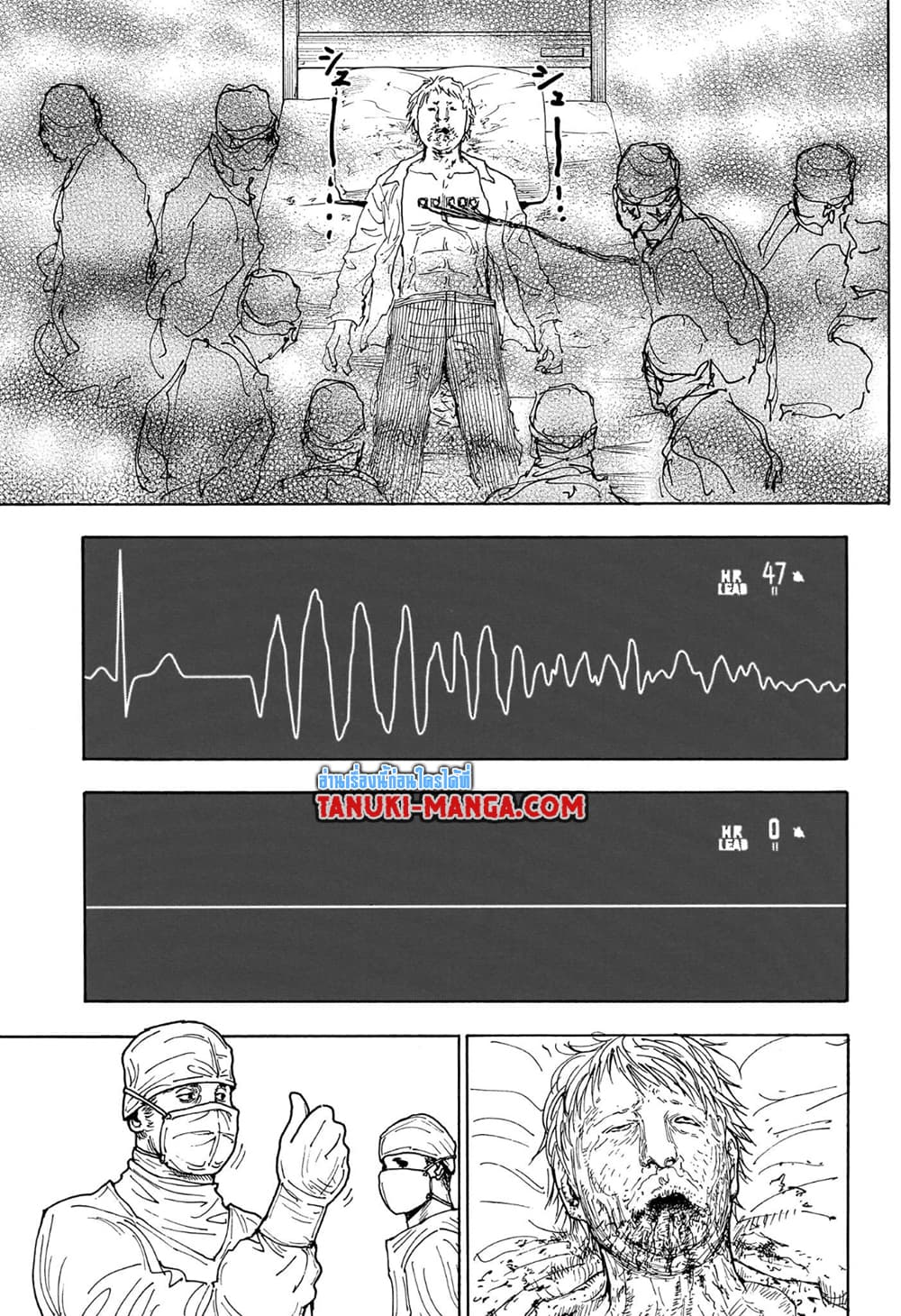 Hunter x Hunter ตอนที่ 404
